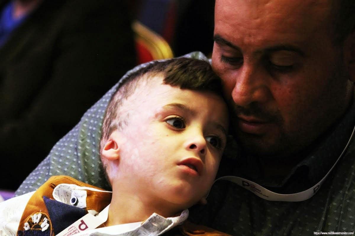 Ahmed Dawabsheh, irmão de Ali Saeed Dawabsheh que foi morto em um incêndio criminoso por colonos