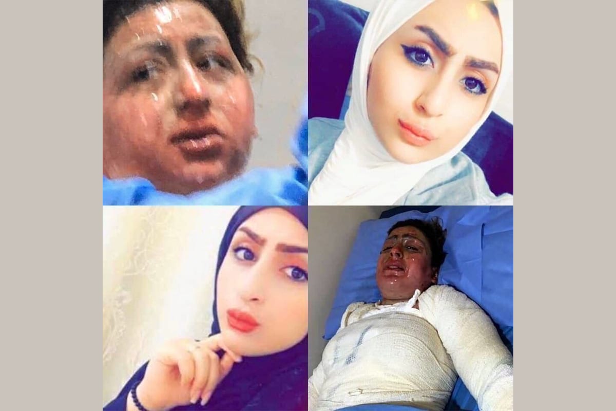 Uma mulher iraquiana, Malak Haider Al-Zubaidi, foi incendiada por seu marido em Najaf, Iraque 14 de abril de 2020 [Twitter] 