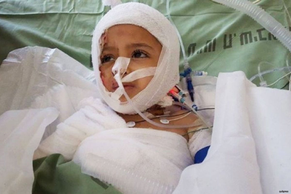 Criança palestina Ahmed Dawabsheh pode ser vista no hospital recebendo tratamento após ser queimado vivo por colonos israelenses [foto de arquivo]