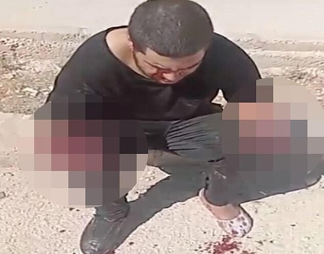 Adolescente jordaniano tem as mãos amputadas e olhos vazados por um ataque de gangue, na cidade de Zarqa, Jordânia [Twitter]
