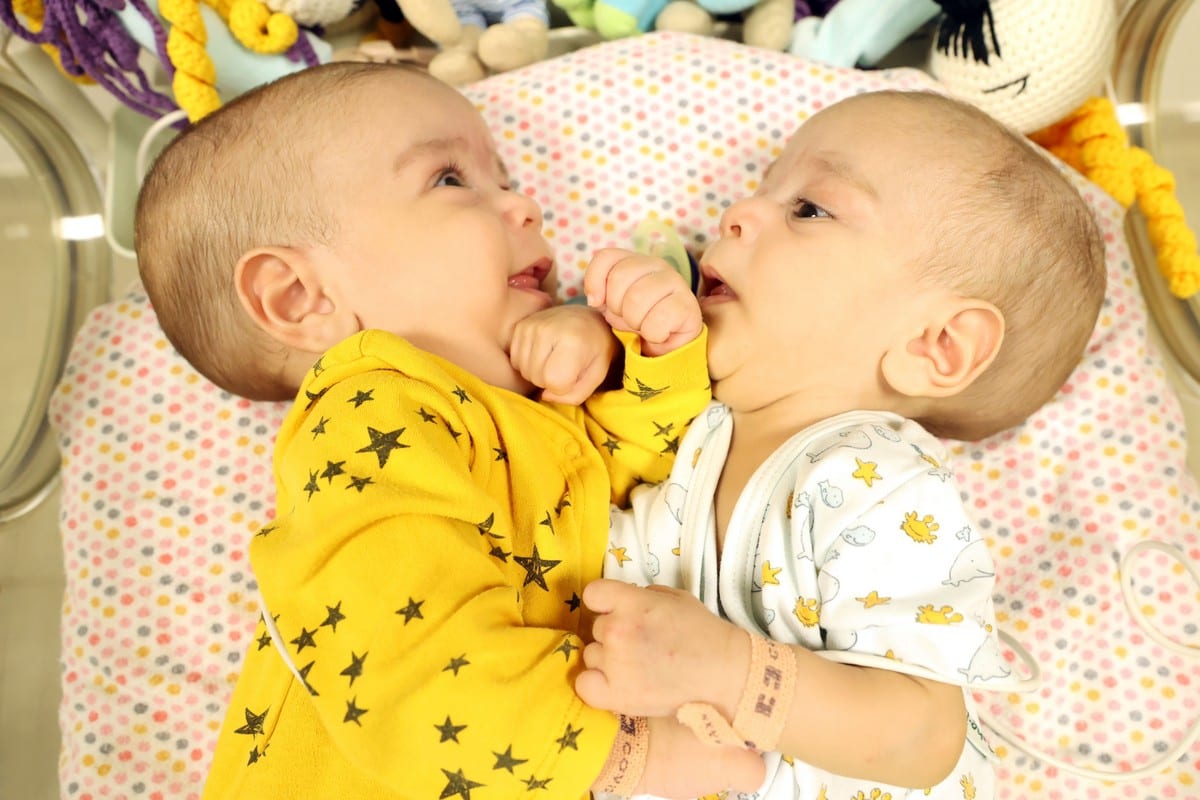 Gêmeos conjugados Bessam e Ihsan no Hospital Universitário de Ancara, na Turquia, 4 de fevereiro de 2021 [Mehmet Kaman/Agência Anadolu]