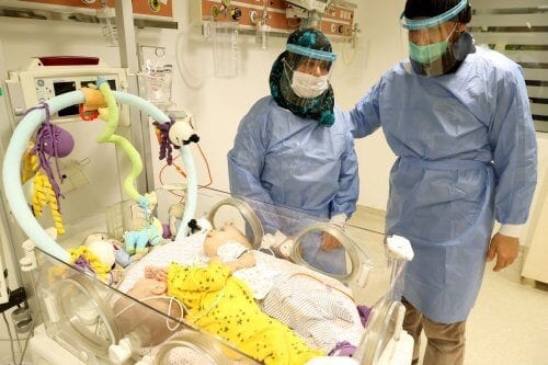 Gêmeos conjugados Bessam e Ihsan no Hospital Universitário de Ancara, na Turquia, 4 de fevereiro de 2021 [Mehmet Kaman/Agência Anadolu]