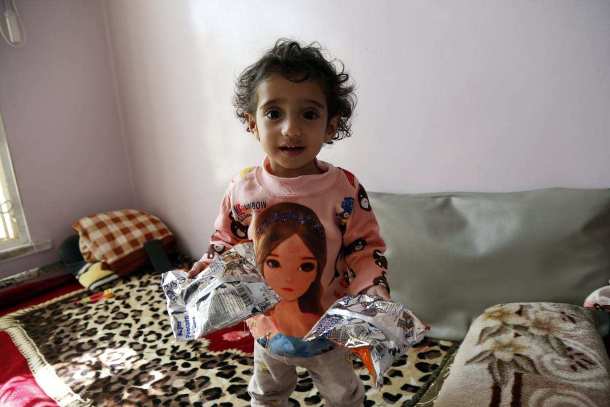 Hospital Al Sabeen trata crianças em situação de desnutrição, em Sanaa, capital do Iêmen, 5 de janeiro de 2021 [Mohammed Hamoud/Agência Anadolu]
