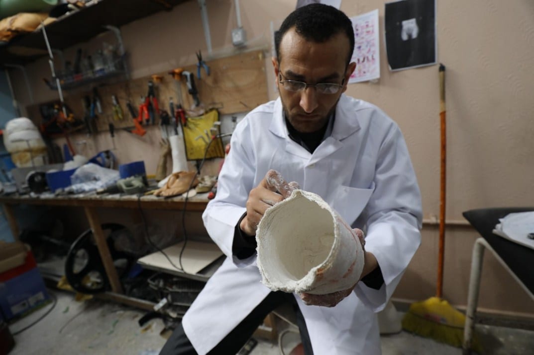 Muhammad Al-Khalidi prepara a perna amputada de um paciente para receber um membro protético em Gaza, em 18 de março de 2021. [Mohammed Asad/Monitor do Oriente Médio]