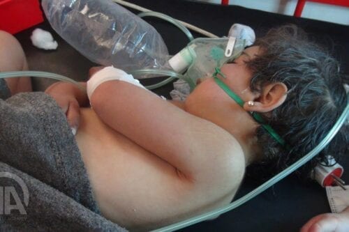 Uma criança síria recebe tratamento após ataque químico do regime de Assad em Idlib, Síria, em 4 de abril de 2017