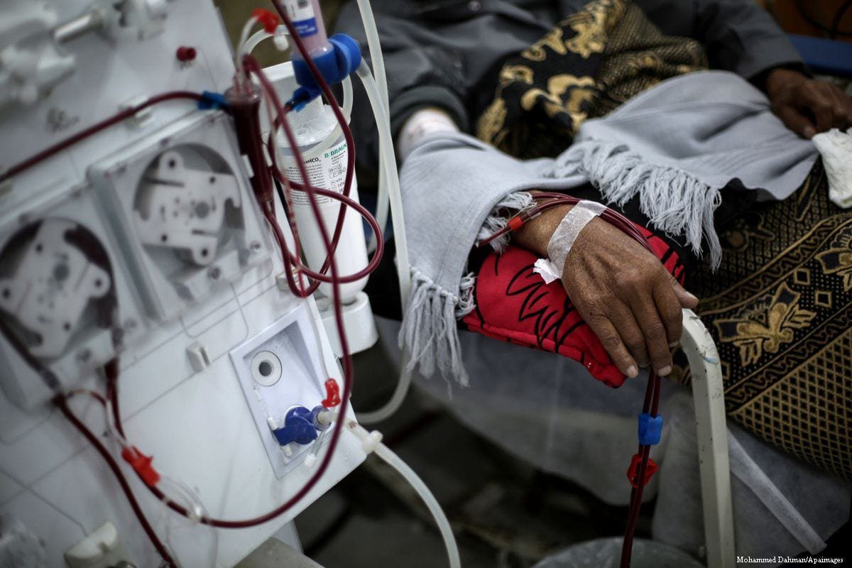 Um paciente palestino lava seus rins no departamento de diálise do hospital Al-Shifa na Cidade de Gaza, em 8 de janeiro de 2017 [Mohammed Dahman/Apaimages]
