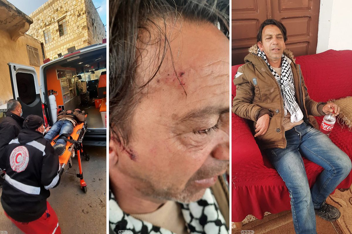 O palestino Samir Ahmed Seif foi ferido por colonos israelenses em Nablus, Cisjordânia, 14 de fevereiro de 2021 [safa.ps/]
