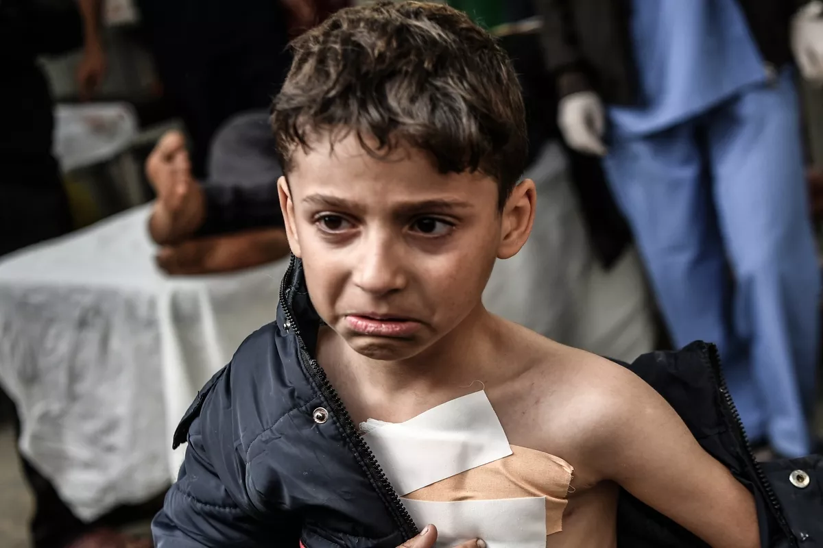 Uma criança palestina é levada ao Hospital Kuwait para receber tratamento médico após os ataques israelenses em Rafah, Gaza, em 8 de janeiro de 2024. [Abed Zagout /Agência Anadolu].
