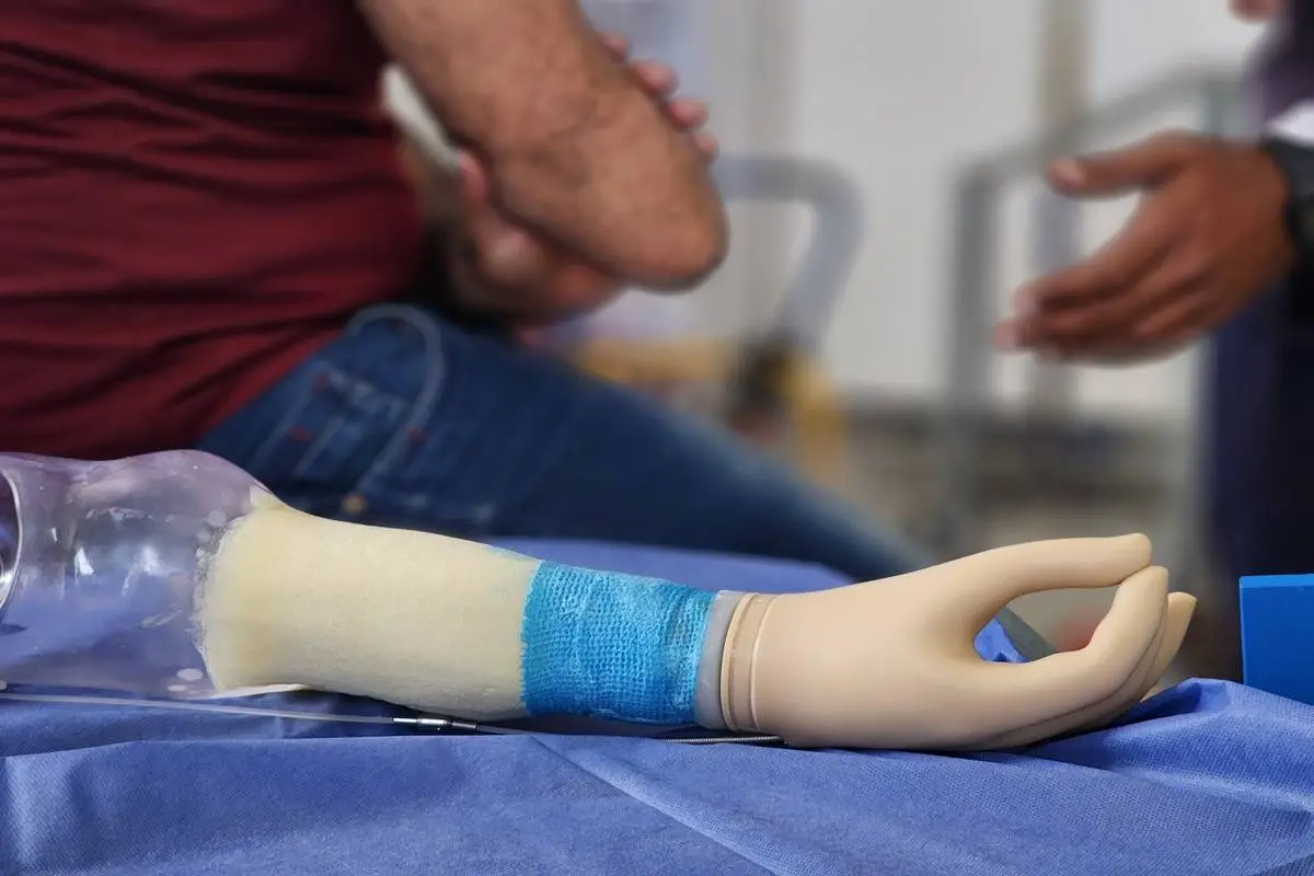 Médicos regulam membros prostéticos a palestinos mutilados pelos ataques de Israel, em Rafah, no sul de Gaza, em 28 de abril de 2024 [Hani Alshaer/Agência Anadolu]
