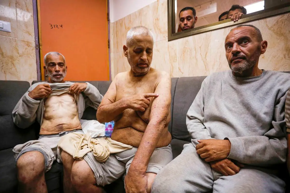 Alguns dos palestinos libertados parecem fracos e têm cicatrizes em seus corpos quando o exército israelense libertou 50 palestinos depois de mais de sete meses de detenção após uma operação militar, em 01 de julho de 2024 [Ashraf Amra/Agência Anadolu]
