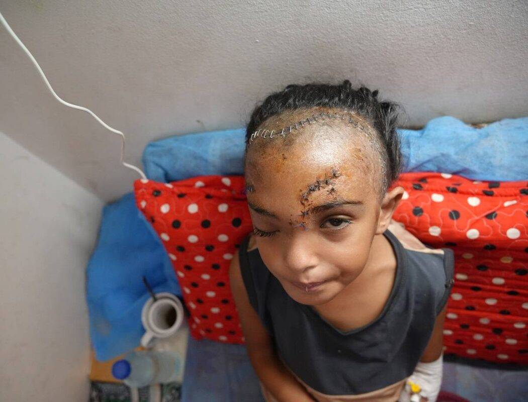 O estado de saúde de Hoso está se deteriorando devido à falta de serviços de saúde. [Anas Zeyad Fteha/Agência Anadolu]