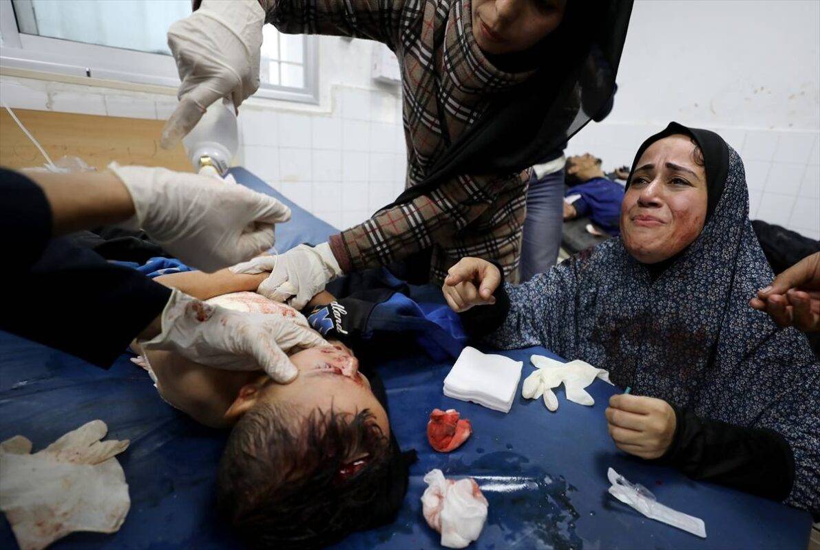 Um menino palestino gravemente ferido recebe tratamento no Hospital Batista Al-Ahli, enquanto profissionais de saúde trabalham com urgência para tratar seus ferimentos após o ataque israelense aos palestinos reunidos do lado de fora da Escola Fahmi Al-Jarqawi na Rua Al-Wahda em Gaza em 16 de novembro de 2024. [Dawoud Abo Alkas/Agência Anadolu]
