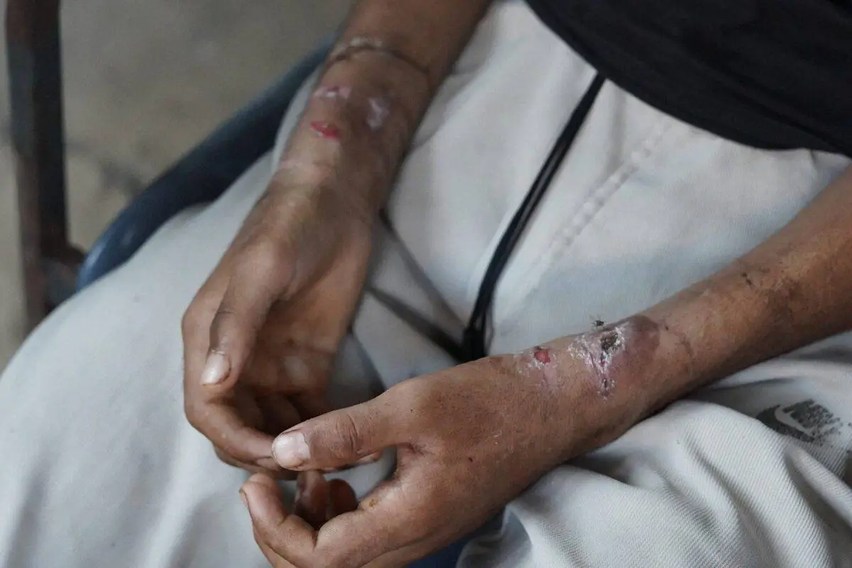 Palestino libertado das cadeias de Israel chega a uma tenda em Deir al-Balah, na Faixa de Gaza, em 27 de julho de 2024 [Anas Zeyad Fteha/Anadolu via Getty Images]