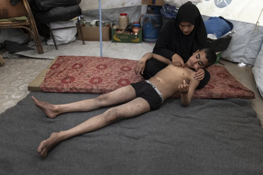 A palestina Wisam Abdulhadi, que perdeu o marido em um ataque israelense, aparece ao lado de seus filhos, que desenvolveram doenças de pele, no local onde estão abrigados, na Universidade Al-Azhar, na Cidade de Gaza, Palestina, em 24 de abril de 2026. [Mahmoud Abu Hamda – Agência Anadolu]