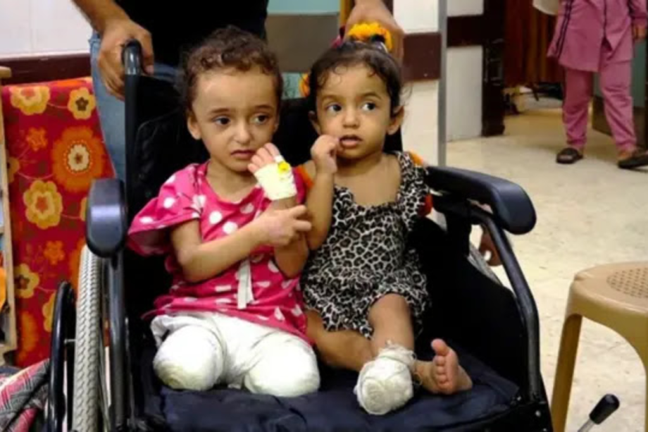 Crianças amputadas de Gaza.